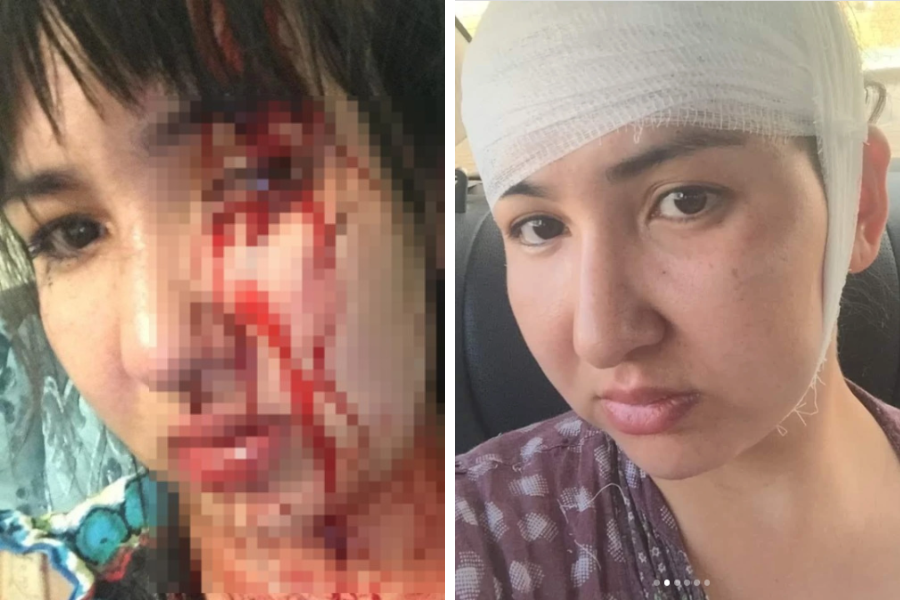 “12 жыл бойы ұрып-соқты“. Атыраулық әйел депутат экс-күйеуін зорлық-зомбылық көрсетті деп айыптады