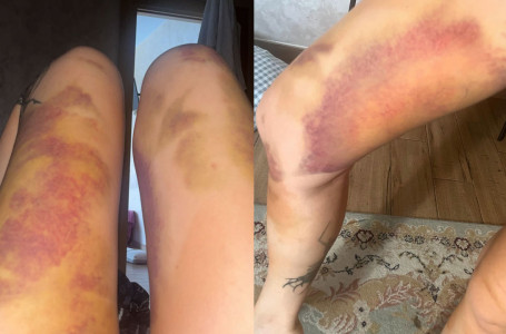 “Бір сағат бойы белбеумен ұрды“. Қазақстандық рэпердің әйелі мәлімдеме жасады