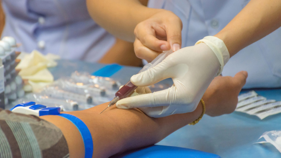 Сирек кездеседі, бірақ ең қауіптісі: саркома туралы не білу керек?