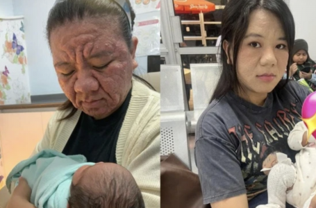 28 жастағы қыз жүкті кезінде адам танымастай қартайып кеткен 