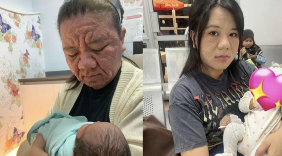 28 жастағы қыз жүкті кезінде адам танымастай қартайып кеткен 