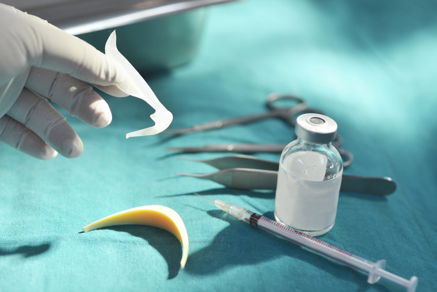 Астанада әйел мұрнына жасатқан отадан кейін қайтыс болды: полиция не дейді?