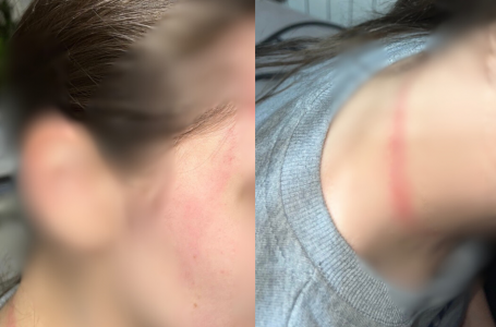 Алматыда ІІМ академиясының курсанты 17 жастағы қызды соққыға жықты деп айыпталды