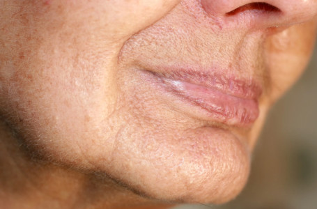 Қартаю үдерісін баяулататын өнім аталды