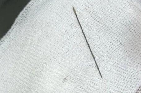 Түркістанда 8 айлық cәбидің ішінен ине табылды