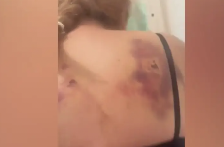 “40-50 рет соққан шығар“. Жетісу облысында ер адам көршісін күрекпен аяусыз ұрған