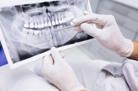 Тегін стоматологиялық көмек кімге көрсетіледі? 