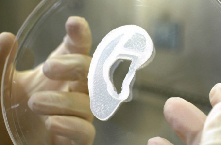 Науқасқа тұңғыш рет 3D принтерде басылған жасанды құлақ салынды 